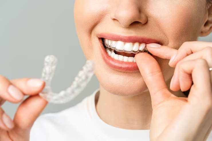 Invisalign in Mount Prospect IL